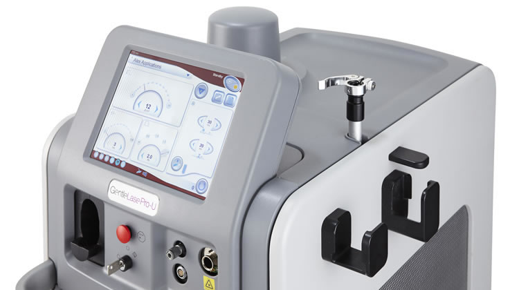 Gentlelase(アレキサンドライトレーザー)