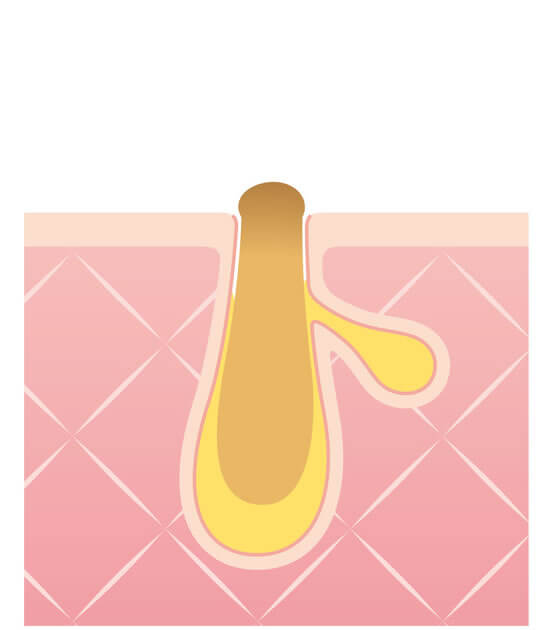 STEP.1