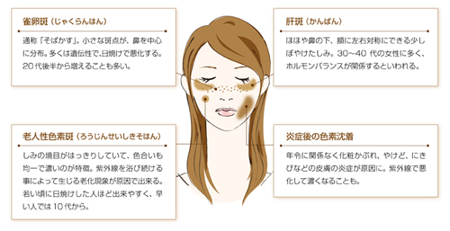 はなさき美容コラム Vol 3 肝斑とシミの治療の違い 美容皮膚科は埼玉県加須市のはなさき皮膚科クリニック